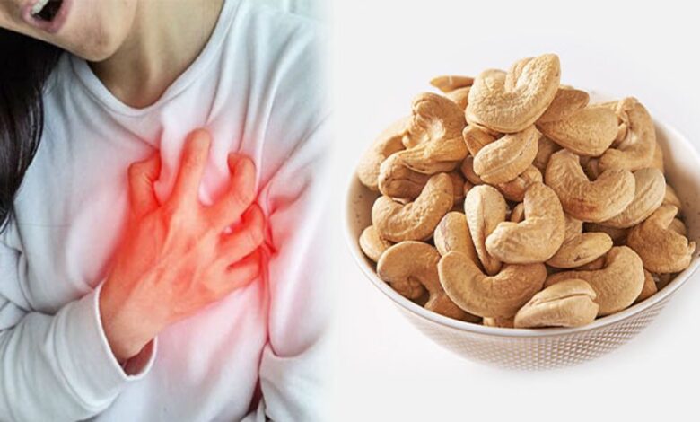 Cashews Increase High Cholesterol: काजू खाने से शरीर में बैड कोलेस्ट्रॉल बढ़ता है? एक्सपर्ट से जानिए क्या है सच्चाई?