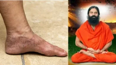 Cause Of Varicose: बाबा रामदेव ने बताया कि वैरिकोज में इस तेल से मसाज करने से बंद नसों में जमा खून बाहर निकलने लगेगा।