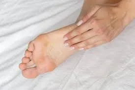 These 5 symptoms of Uric Acid are visible in hands and feet, ignoring them can be costly!