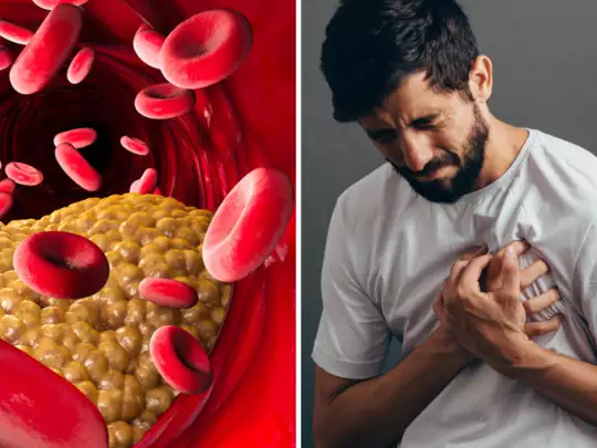 Cholesterol Range Chart: कोलेस्ट्रॉल कितना  खतरनाक होता है, कब डेंजर कंडीशन पैदा होती है? कितने जानें पूरा चार्ट