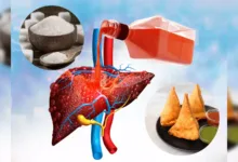 Worst Foods for Your Liver: तीन खाद्य पदार्थ आपके लीवर को नुकसान पहुंचाते हैं; आपको भूलकर भी इनका सेवन नहीं करना चाहिए।