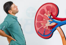 Kidney Infection Symptoms: किडनी में इंफेक्शन के ये लक्षण दिखते हैं, जानिए इसके कारण और संक्रमण से बचने के लिए क्या बरतें सावधानियां।