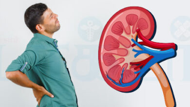 Kidney Infection Symptoms: किडनी में इंफेक्शन के ये लक्षण दिखते हैं, जानिए इसके कारण और संक्रमण से बचने के लिए क्या बरतें सावधानियां।