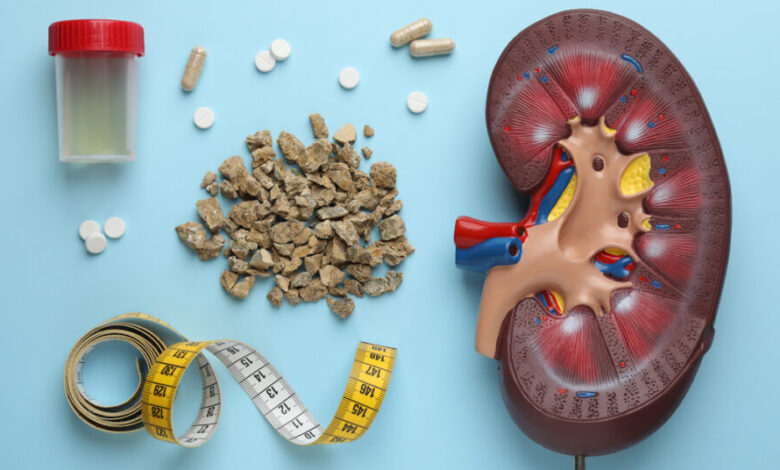 Kidney Stone Treatment: किडनी में पथरी क्यों होती है और क्या इसको रोका जा सकता है? 1 Kidney Stone Treatment: किडनी में पथरी क्यों होती है और क्या इसको रोका जा सकता है?