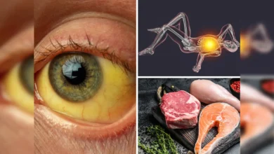Vitamin For Eyes: कमजोर नजर के पीछे इस विटामिन की कमी बड़ा कारण है, इन चीजों को खाने से Vitamin मिलेगा