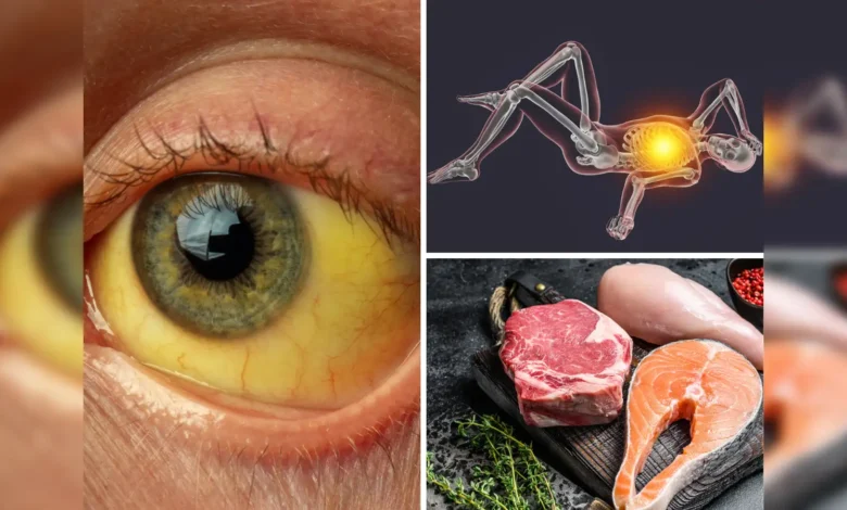 Vitamin For Eyes: कमजोर नजर के पीछे इस विटामिन की कमी बड़ा कारण है, इन चीजों को खाने से Vitamin मिलेगा