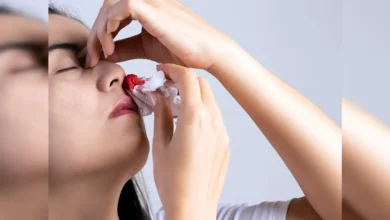 Nose Bleeding Home Remedies: नाक से गर्मियों में खून क्यों निकलता है? अगर ऐसा हो जाए तो क्या करें? जानें