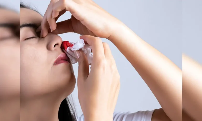 Nose Bleeding Home Remedies: नाक से गर्मियों में खून क्यों निकलता है? अगर ऐसा हो जाए तो क्या करें? जानें 1 Nose Bleeding Home Remedies: नाक से गर्मियों में खून क्यों निकलता है? अगर ऐसा हो जाए तो क्या करें? जानें