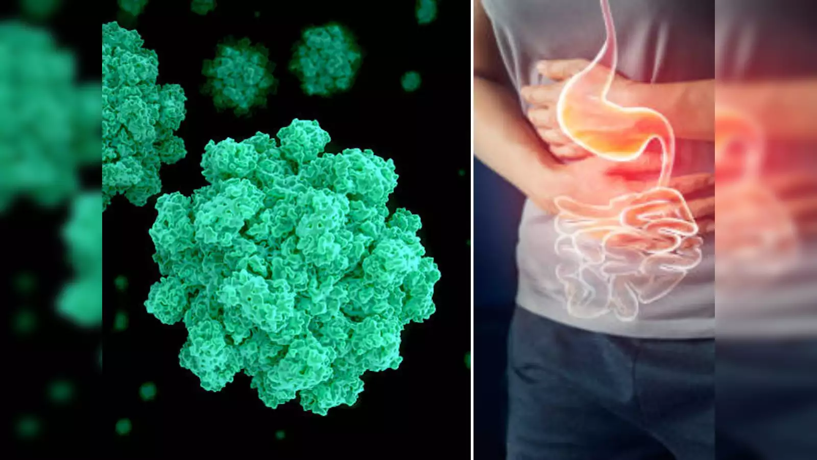 Norovirus Symptoms: लग्जरी क्रूज पर नोरोवायरस का प्रकोप फैला: 200 से अधिक लोग संक्रमित हुए, जानिए लक्षण और बचाव