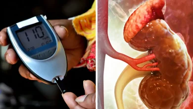 Kidney Disease: शुगर के मरीजों में किडनी की बीमारियों का खतरा अधिक बढ़ जाता है, जानिए बचाव कैसे करें