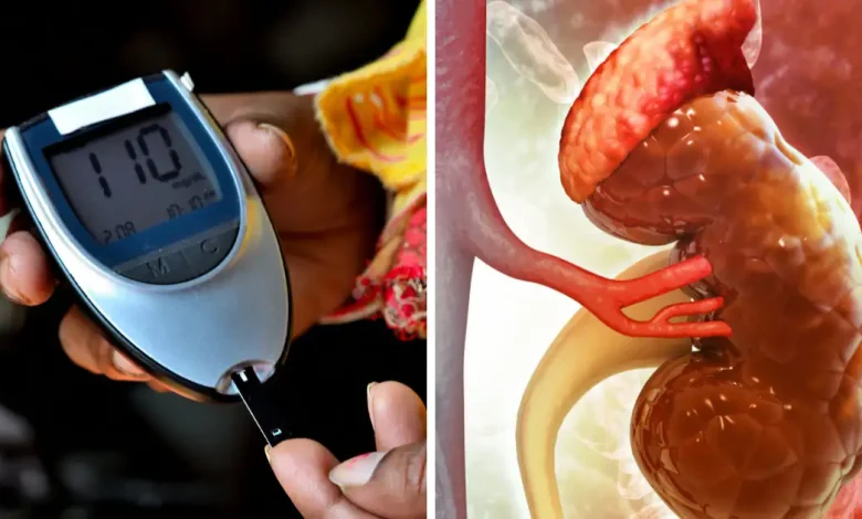 Kidney Disease: शुगर के मरीजों में किडनी की बीमारियों का खतरा अधिक बढ़ जाता है, जानिए बचाव कैसे करें