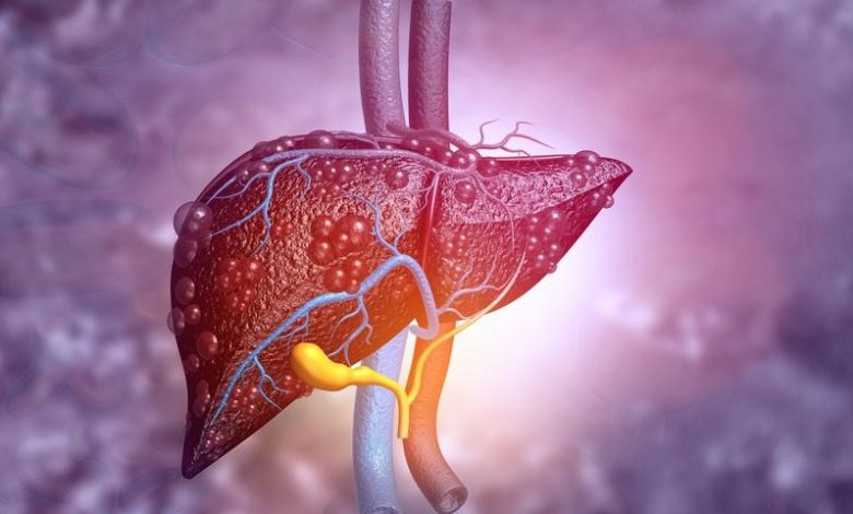 Symptoms Of Liver Cancer: एक्सपर्ट से जानें लिवर कैंसर के लक्षण, किन लोगों को सबसे अधिक खतरा होता है, और बचाव के उपाय 1 Symptoms Of Liver Cancer: एक्सपर्ट से जानें लिवर कैंसर के लक्षण, किन लोगों को सबसे अधिक खतरा होता है, और बचाव के उपाय