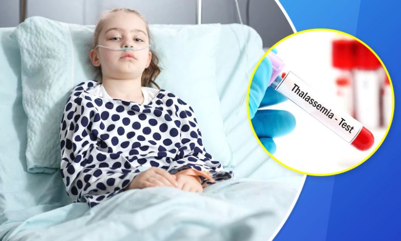Thalassemia में खून सूखने लगता है, बच्चे शिकार होते हैं; डॉक्टर से जानें लक्षण और बचाव के उपाय