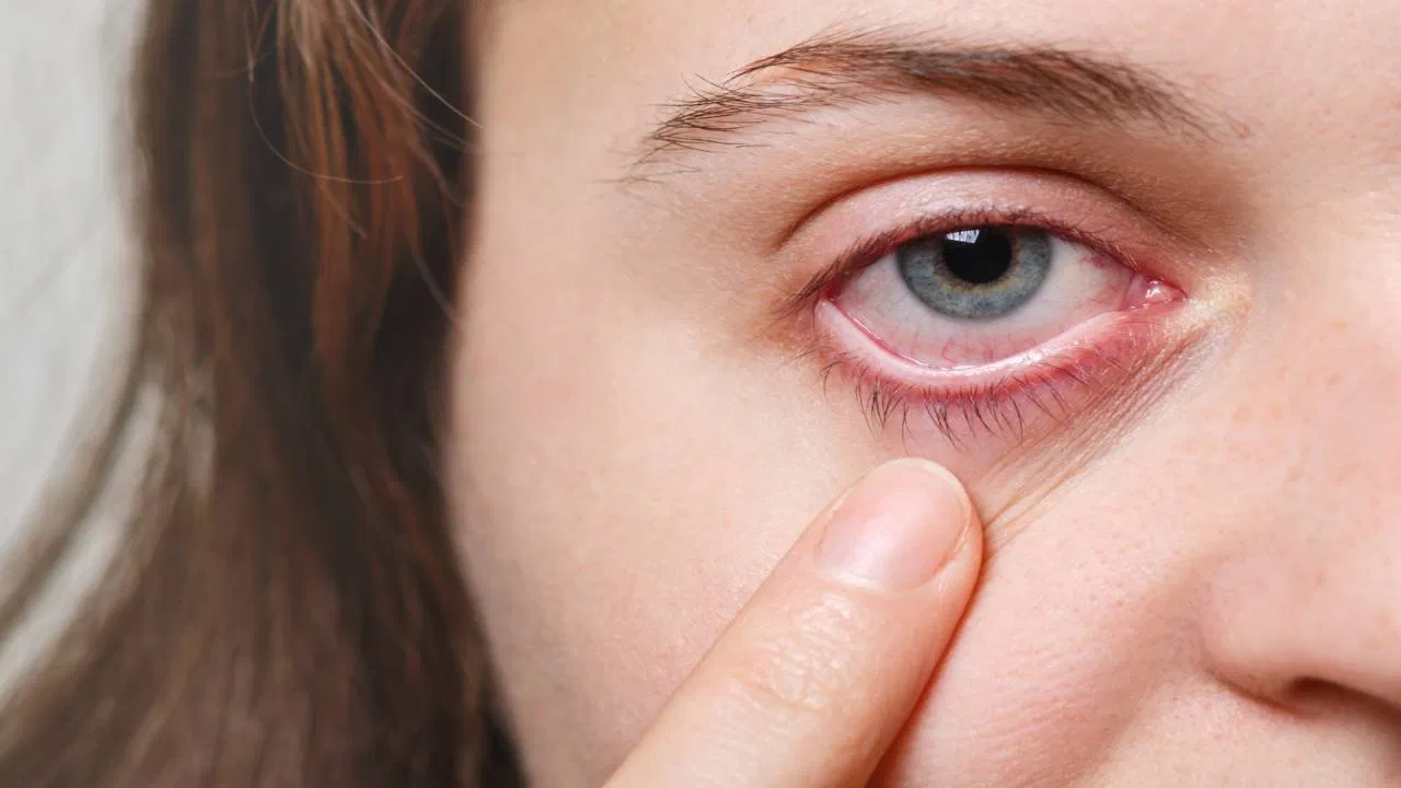 Tips To Improve Eyesight: नज़रअंदाज़ न करें नज़र की कमज़ोरी को! जानें किन कारणों से आँखों की रौशनी कम होती है और कैसे इसे बढ़ा सकते हैं