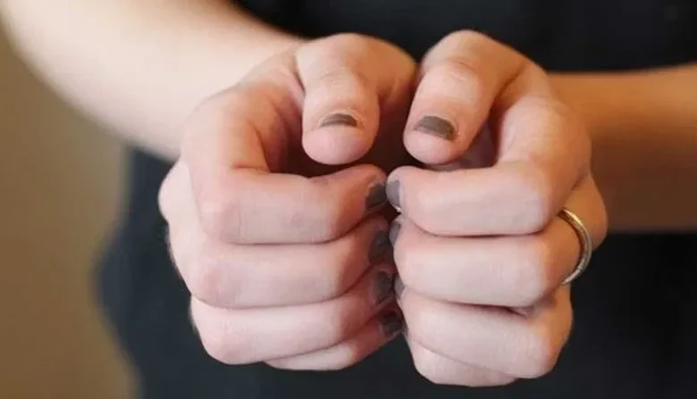 White Spots On Nails Causes: नाखूनों पर सफेद धब्बे पड़ने का संकेत क्या है? जानिए शरीर में किस चीज की कमी से ऐसा होता है? 1 White Spots On Nails Causes: नाखूनों पर सफेद धब्बे पड़ने का संकेत क्या है? जानिए शरीर में किस चीज की कमी से ऐसा होता है?