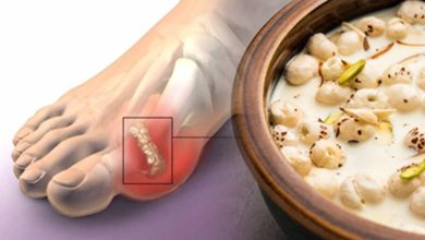 High Uric Acid के मरीज मखाना खा सकते हैं या नहीं? लाभ और नुकसान एक्सपर्ट की सलाह जानिए