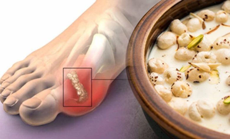 High Uric Acid के मरीज मखाना खा सकते हैं या नहीं? लाभ और नुकसान एक्सपर्ट की सलाह जानिए