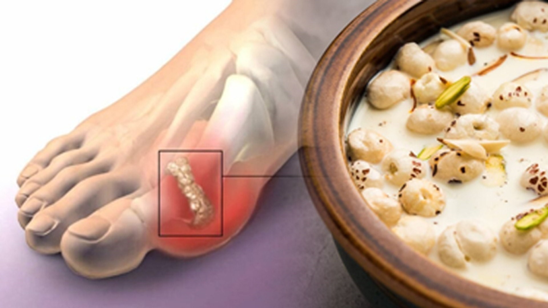 High Uric Acid के मरीज मखाना खा सकते हैं या नहीं? लाभ और नुकसान एक्सपर्ट की सलाह जानिए 12 High Uric Acid के मरीज मखाना खा सकते हैं या नहीं? लाभ और नुकसान एक्सपर्ट की सलाह जानिए