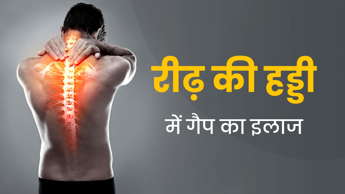 Spinal Problems Symptoms: ये लक्षण रीढ़ की हड्डी में गैप होने पर दिखाई देते हैं, भारी पड़ सकती है