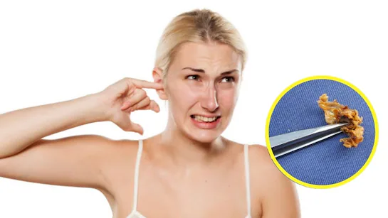 How To Clean Ear Wax: कान से पीला मैल मिनटों में निकालने का आसान तरीका