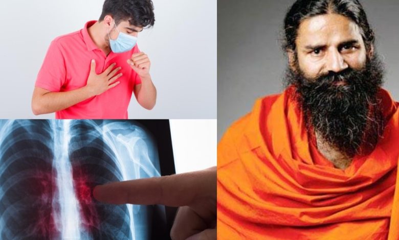 TB Treatment: स्वामी रामदेव से जानिए टीबी को जड़ से दूर करने के घरेलू उपाय