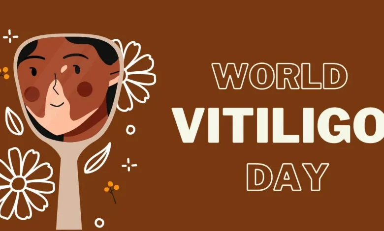 World Vitiligo Day 2025: विटिलिगो की शुरुआती पहचान और समय पर इलाज की अहमियत
