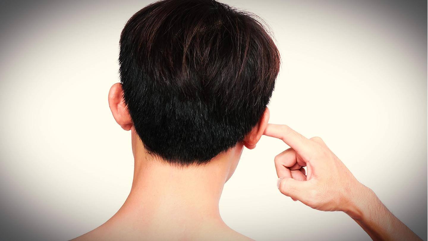 रातों की नींद हराम कर देती है कान की खुजली? बस अपनाएं ये आसान घरेलू उपाय और तुरंत पाएं राहत 12 रातों की नींद हराम कर देती है कान की खुजली? बस अपनाएं ये आसान घरेलू उपाय और तुरंत पाएं राहत