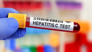 Hepatitis Symptoms: हेपेटाइटिस के दौरान शरीर में दिखने वाले लक्षण और सावधानियों की पूरी जानकारी