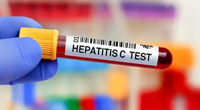 Hepatitis Symptoms: हेपेटाइटिस के दौरान शरीर में दिखने वाले लक्षण और सावधानियों की पूरी जानकारी