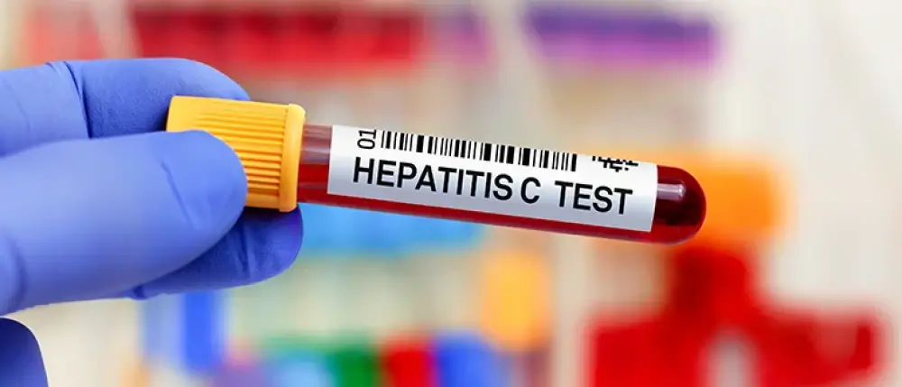Hepatitis Symptoms: हेपेटाइटिस के दौरान शरीर में दिखने वाले लक्षण और सावधानियों की पूरी जानकारी