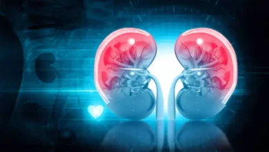 किडनी स्टोन के कारण: किडनी स्टोन का खतरा बढ़ाने वाली गलत आदतें: जानें बचाव के जरूरी उपाय