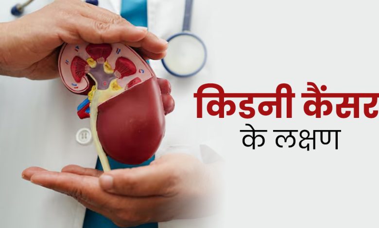 किडनी कैंसर के लक्षण: लगातार पीठ दर्द हो तो तुरंत डॉक्टर से जांच कराएं