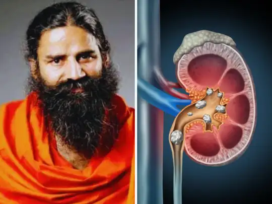 Tips For Healthy Kidney: बाबा रामदेव ने सिर्फ एक महीने में किडनी और दिमाग को स्वस्थ बनाने के लिए ये प्राकृतिक तरीके बताए हैं।