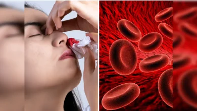 स्टेज 1 लंग कैंसर के शुरुआती लक्षण: जानिए कब हो जाएं सावधान