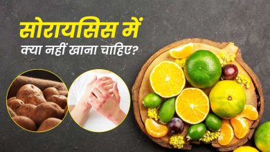 सोरायसिस में क्या-क्या नहीं खाना चाहिए? जानिए इससे बचने के टिप्स