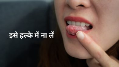 बार-बार मुंह में छाले क्यों होते हैं? जानिए किस विटामिन की कमी से जुड़ी समस्या और उपाय