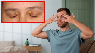 आंखों में जैंथेलास्मा दिखें, तो समझ जाएं शरीर में बढ़ रहा है कोलेस्ट्रॉल का स्तर – जानें कारण, लक्षण और बचाव के उपाय