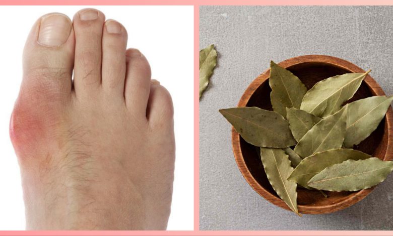 हड्डियों में जमे प्यूरिन को पिघलाएगा तेजपत्ता: जानें यूरिक एसिड में इसका सही सेवन