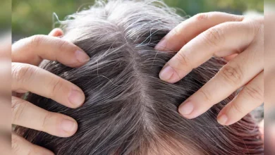 White Hair Causes: कुछ लोगों के बाल बचपन से ही सफेद क्यों हो जाते हैं? जानें कौन से विटामिन की कमी है जिम्मेदार