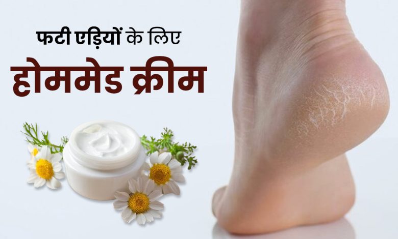 सर्दियों में फटी एड़ियों की समस्या से परेशान हैं? तो यहां जानें एक असरदार DIY क्रीम बनाने का तरीका!