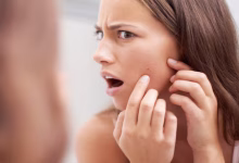 कील-मुंहासों के निशान: चेहरे के गड्ढों को भरने के आसान और असरदार तरीके