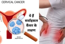 सर्वाइकल कैंसर: ये लक्षण नजरअंदाज करने से हो सकता है सर्वाइकल कैंसर, जानें क्यों महिलाएं ज्यादा खतरे में हैं