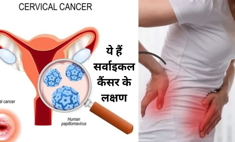 सर्वाइकल कैंसर: ये लक्षण नजरअंदाज करने से हो सकता है सर्वाइकल कैंसर, जानें क्यों महिलाएं ज्यादा खतरे में हैं