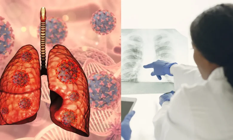 फेफड़ों का संक्रमण: आयुर्वेदिक उपचार और घर पर अपनाए जाने वाले उपाय