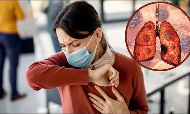 “टीबी के लक्षण और सावधानी – Tuberculosis early symptoms awareness”
