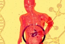 फैटी लिवर के कारण और इलाज दर्शाता मेडिकल इन्फोग्राफिक जिसमें लिवर में फैट जमा होने की स्थिति दिखाई गई है