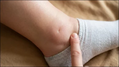 वॉटर रिटेंशन के कारण शरीर में सूजन, पैरों और टखनों में सूजन की जानकारी